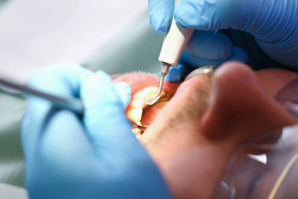 Best Emergency Dentist for Knocked-Out Tooth in Ignacio, CO